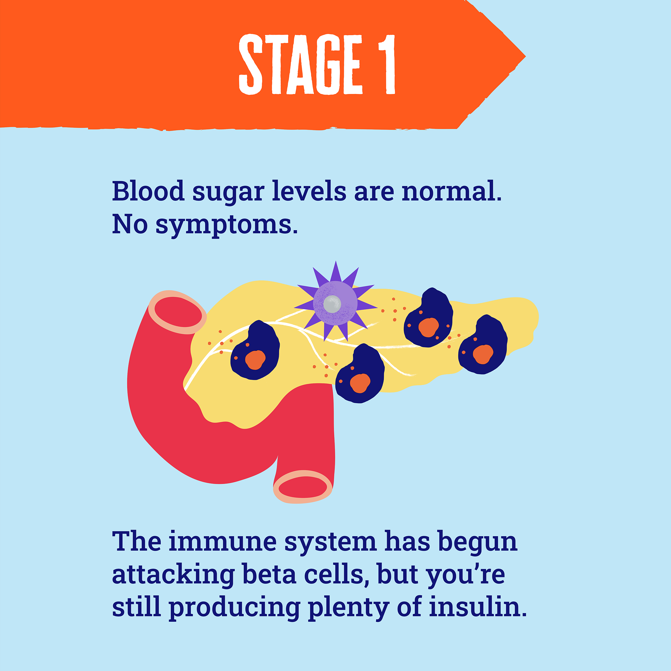 Illustration of lots beta cells in a pancreas, with a single attacking immune cell